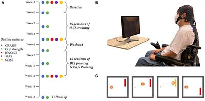 Brain-Computer Interface Priming for Cervical Transcutaneous Spinal Cord Stimulation Therapy: An Exploratory Case Study